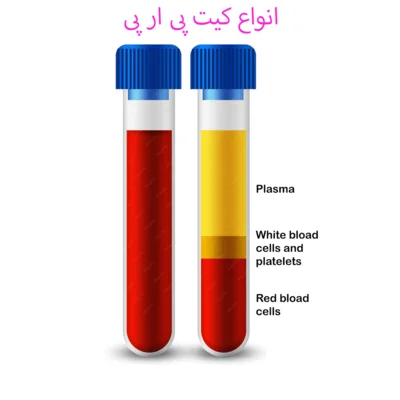 انواع کیت پی ار پی