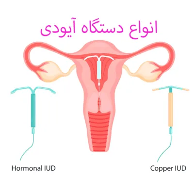 محصولات آیودی