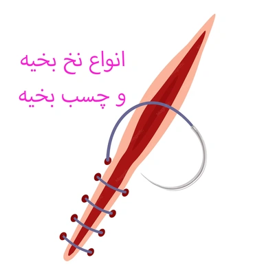 بخیه